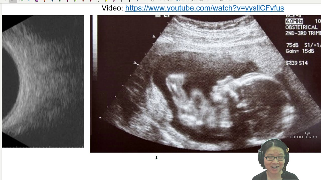 24.3a Ultrasound Detection & Generation | A2 Medical Physics Ultrasound | CAIE A Level Physics