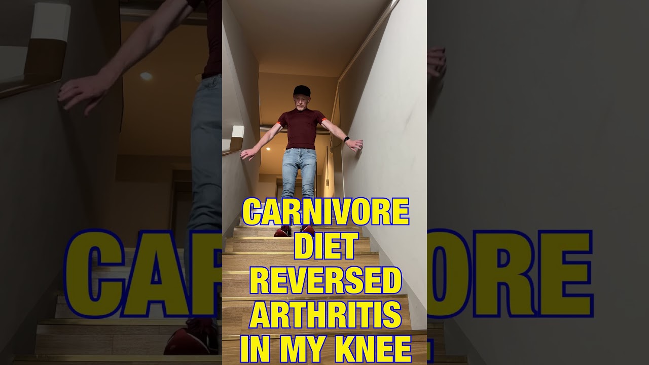 Carnivore Diet Reversed My Knee Arthritis