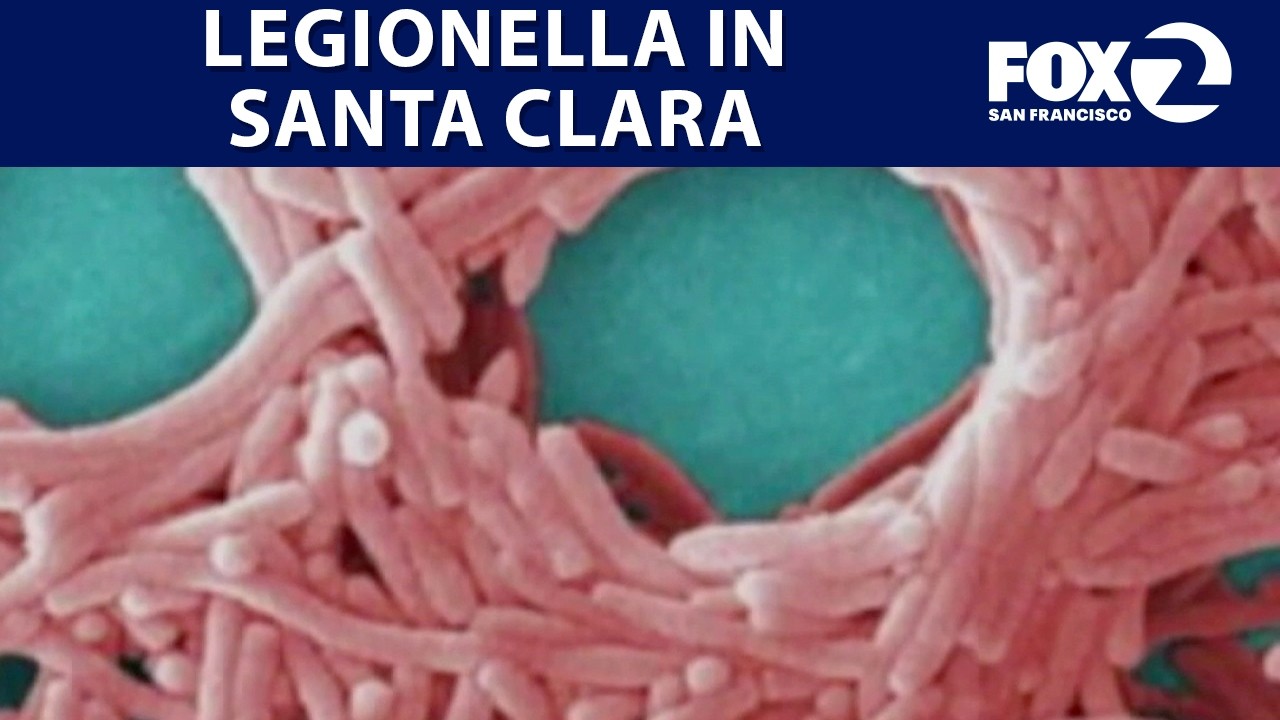 В больнице Kaiser Permanente Santa Clara подтверждено 18 случаев заражения легионеллой | KTVU