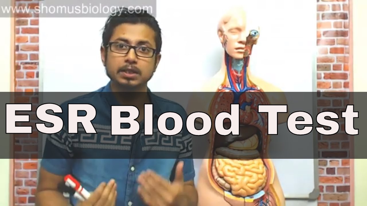ESR test in Hindi (erythrocyte sedimentation rate test)