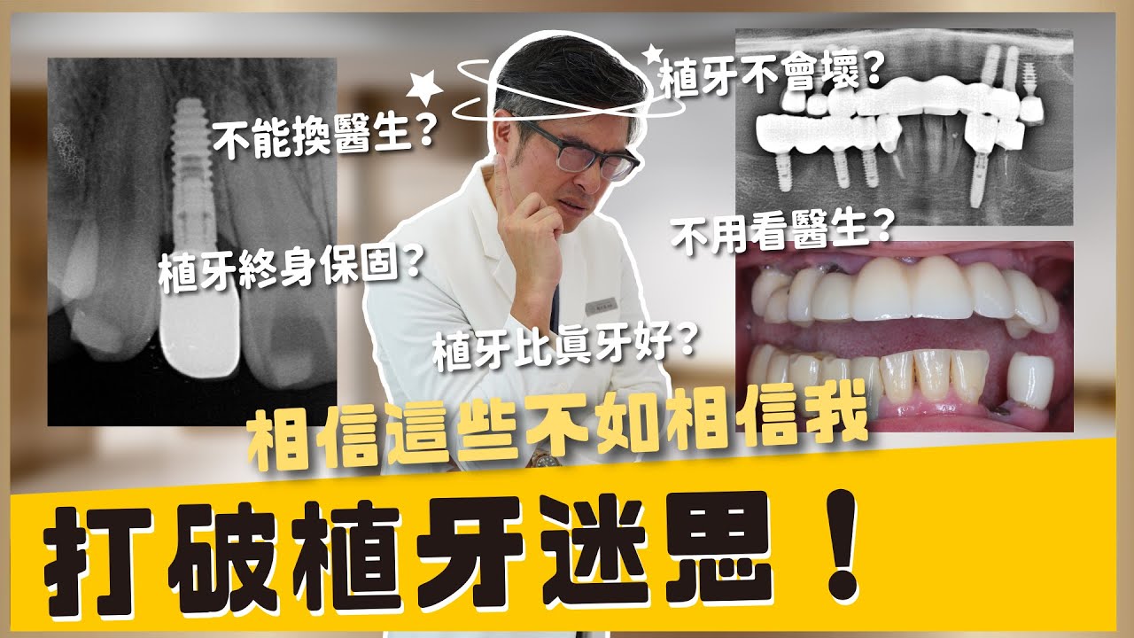 【植牙 #27】植牙的5大迷思，你還在相信？相信這些不如相信楊醫師！植牙別再被誤導！楊醫師破解植牙的5大迷思！｜【祐民牙醫－隱適美旗艦店】鑽石級楊大為醫師 #植牙 #迷思 #祐民牙醫