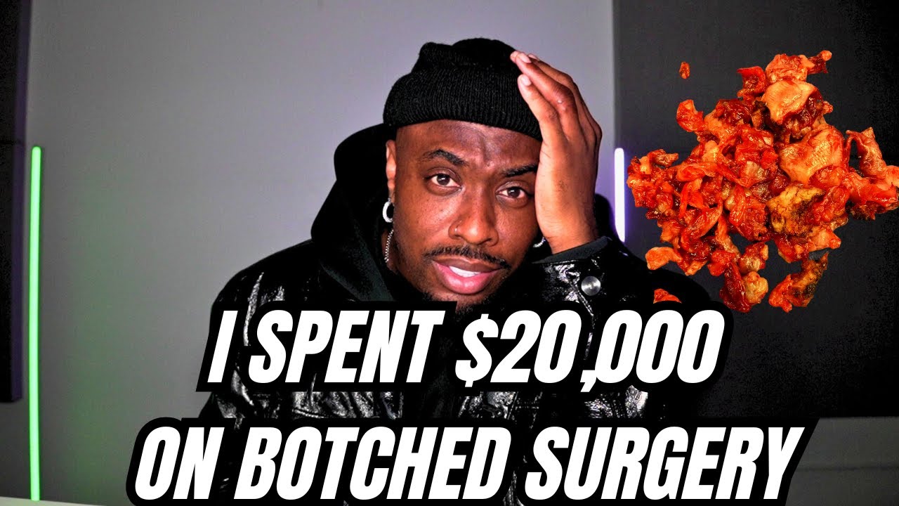I Spent $20,000 on PLASTIC SURGERY and got BOTCHED- It CHANGE my life FOREVER