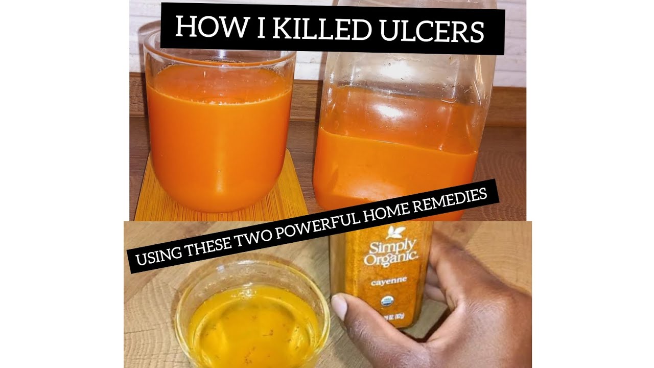 How to cure ulcers naturally|| powerful Home remedy