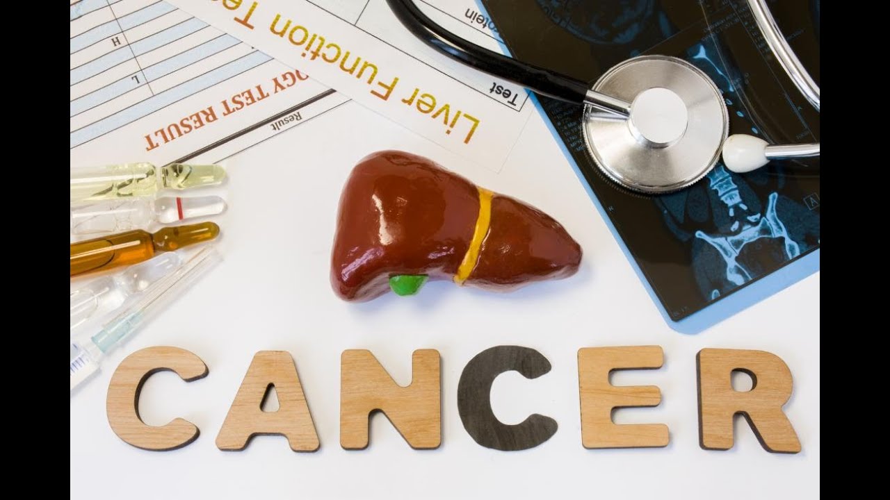 Comment Je Détruis les Tumeurs du Foie sans Chirurgie : La ChimioEmbolisation