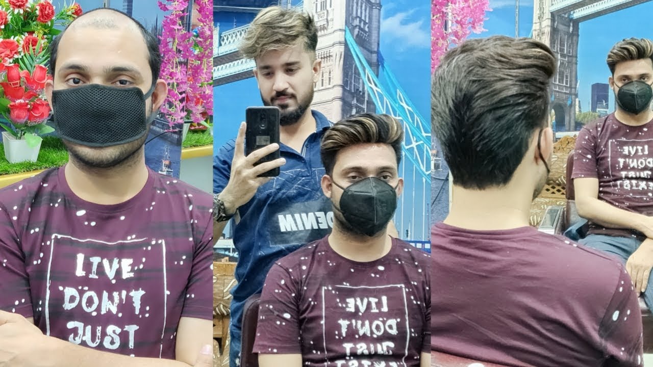 Non surgical hair replacement system by anas sheikh, call us 9650914665 consultant at WhatsApp