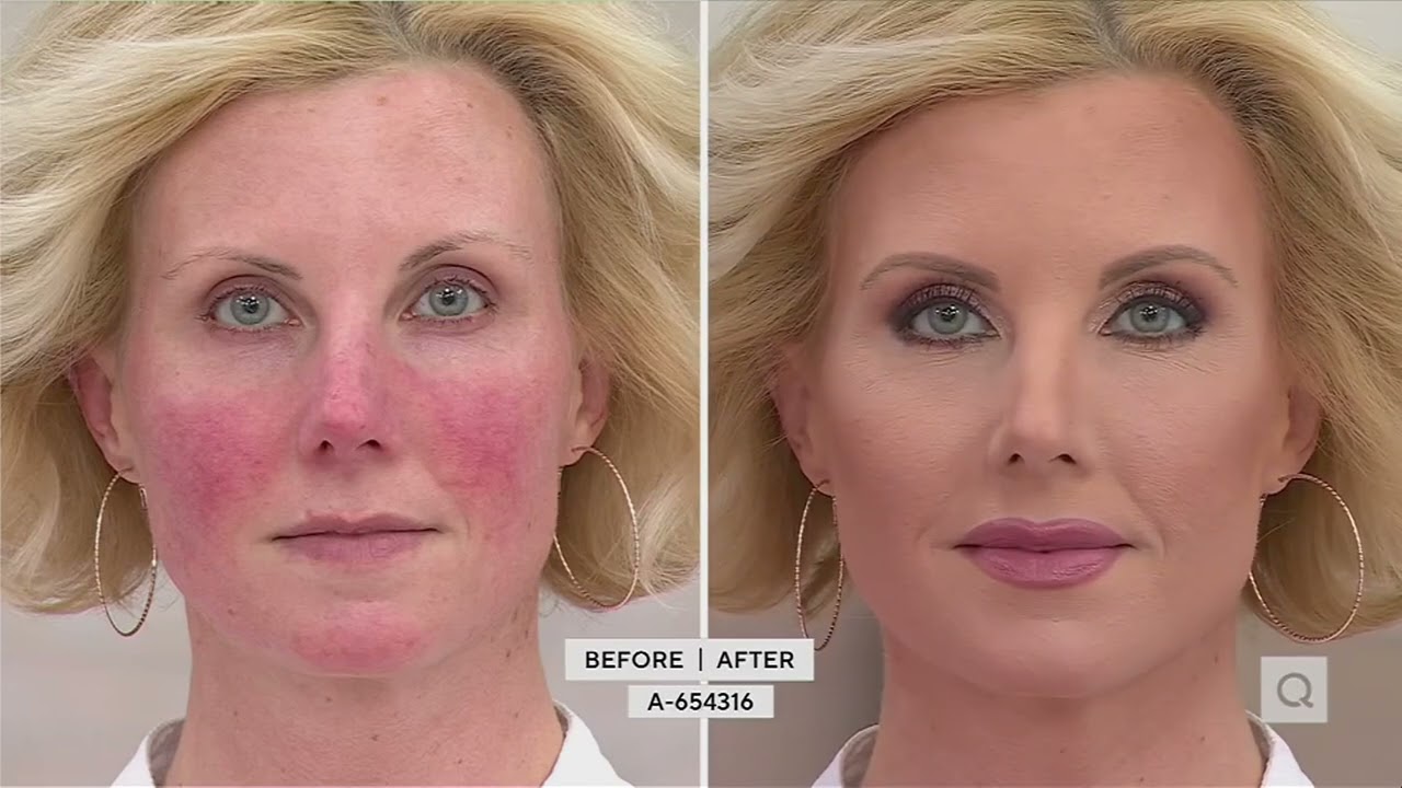 Mally 5-Piece Lip Library on QVC