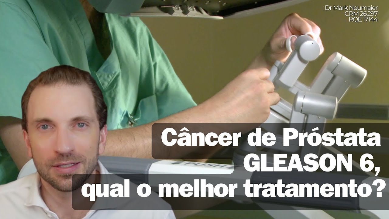Câncer de Próstata Gleason 6! Qual o tratamento?!