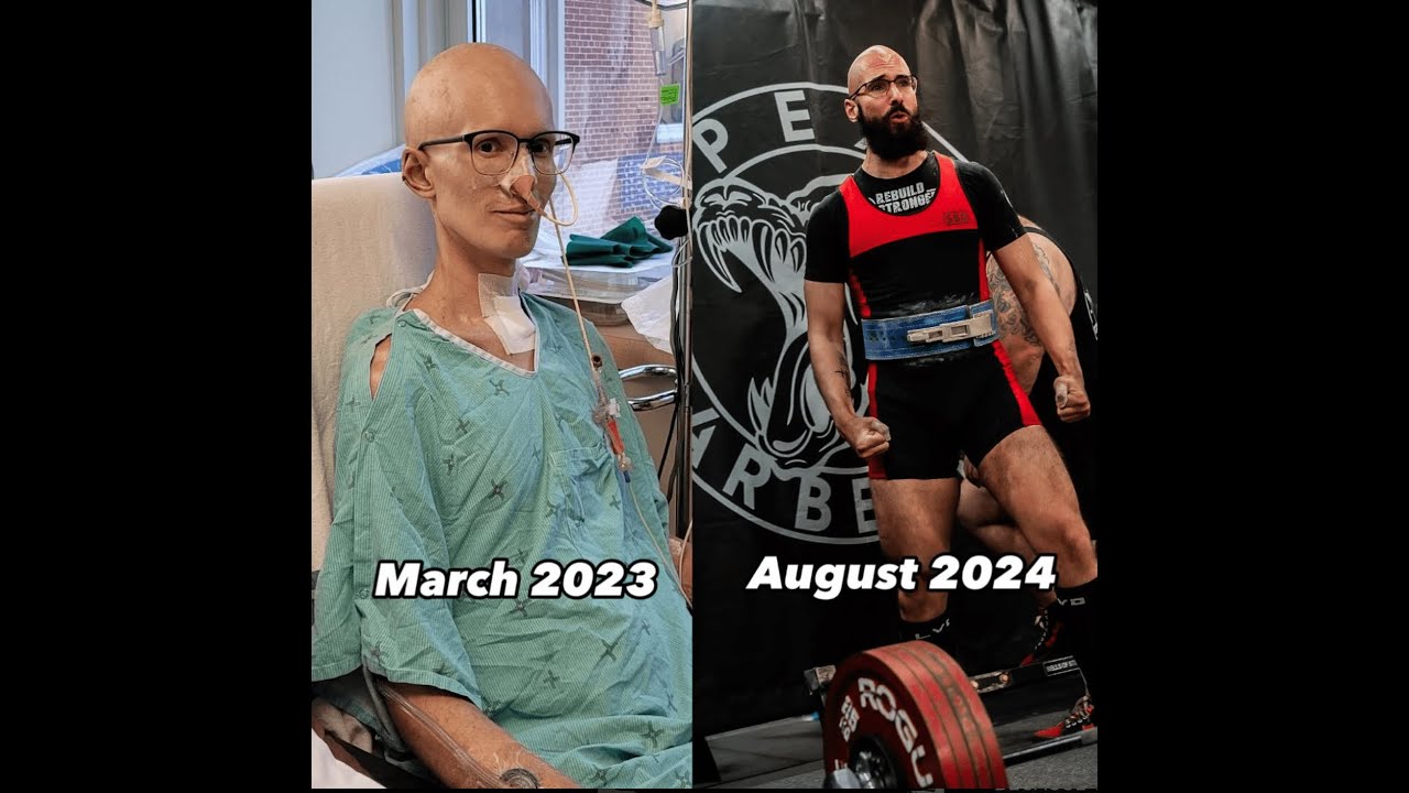 INSPIRATIONAL: Jared Maynard Physiotherapist on his battle with HLH