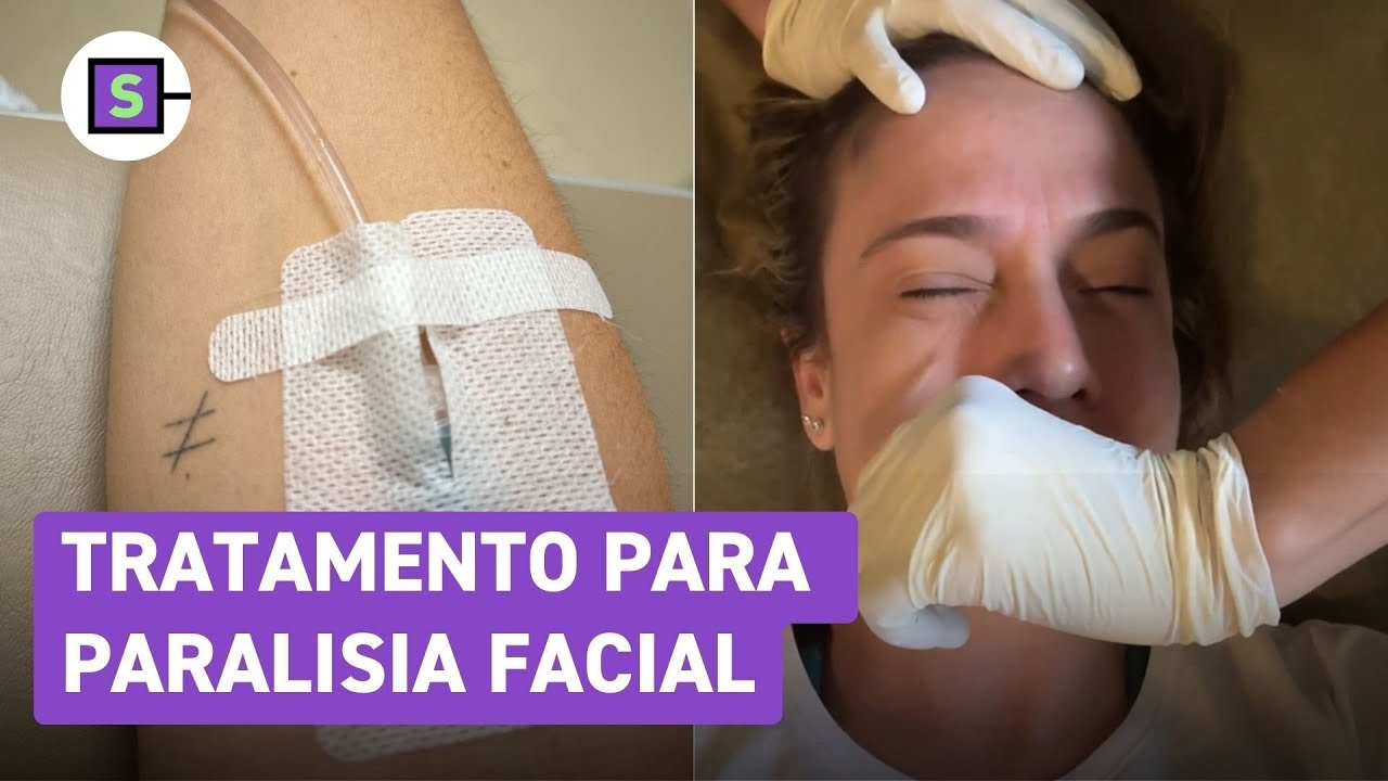 Fernanda Gentil mostra tratamento para paralisia facial