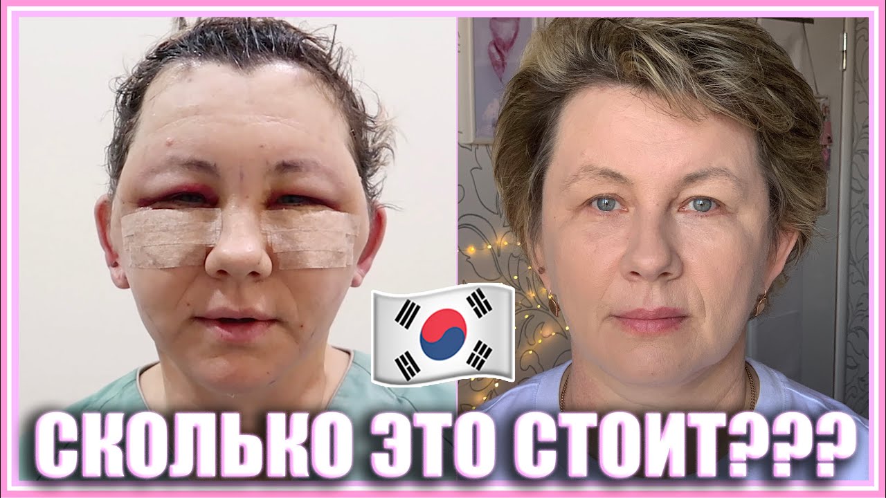 СКОЛЬКО ЭТО СТОИТ? Все, что вы хотели знать о нашей ПЛАСТИЧЕСКОЙ ОПЕРАЦИИ В Корее 💖🇰🇷🏩