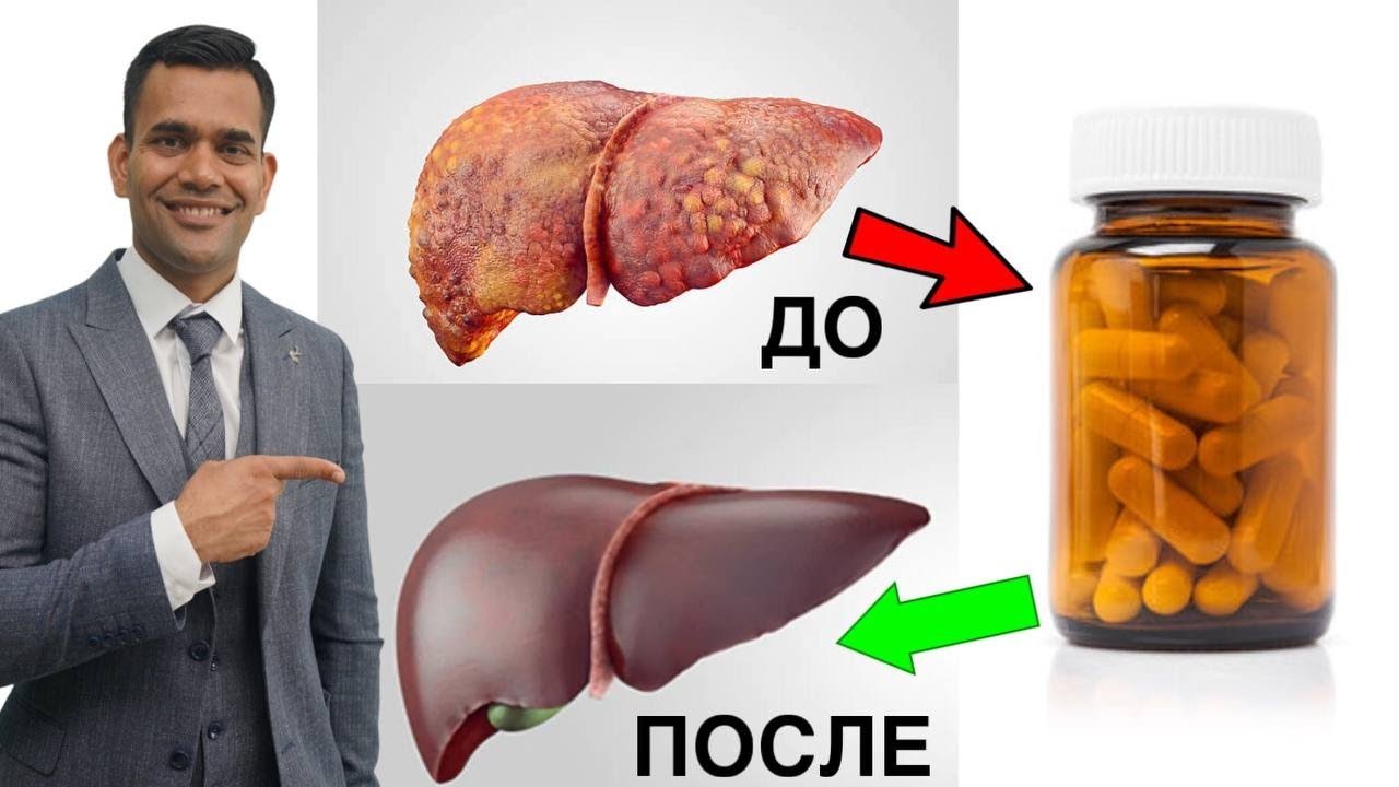 Лучший Витамин Для Очищения Печени | Доктор Вивек