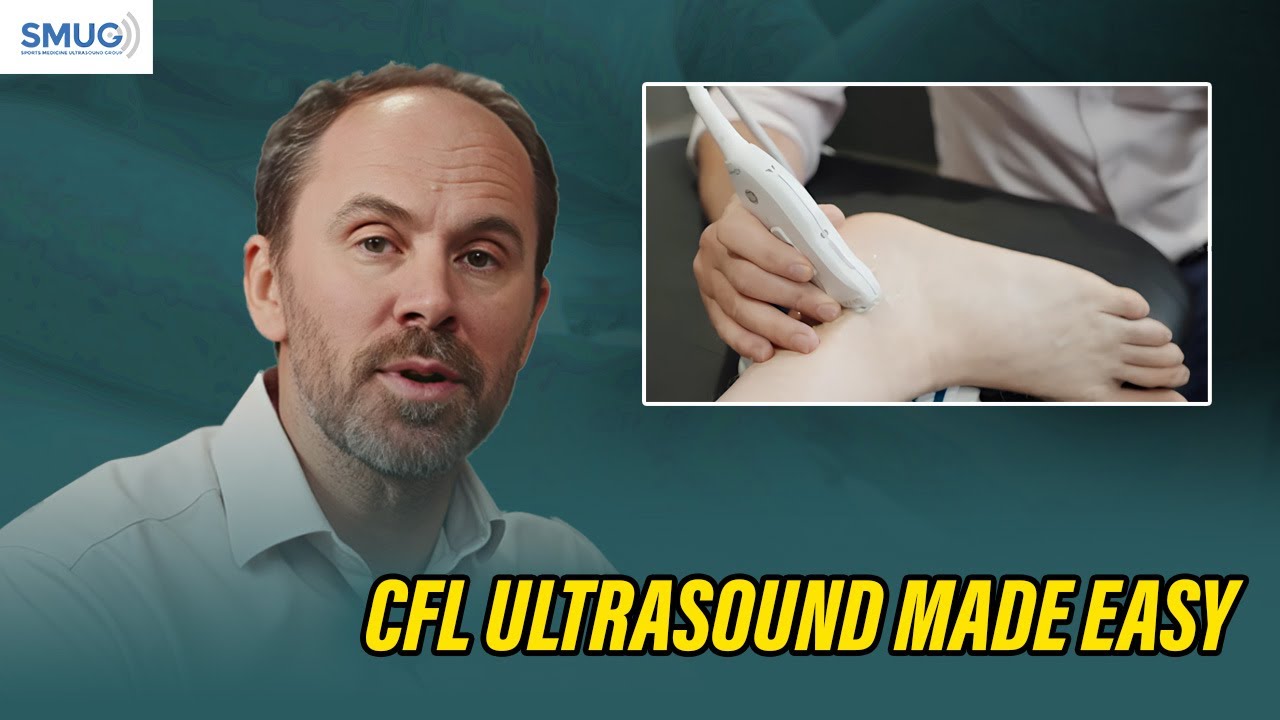How to Scan the Calcaneofibular Ligament (CFL) with MSK Ultrasound | Expert Scanning Tips