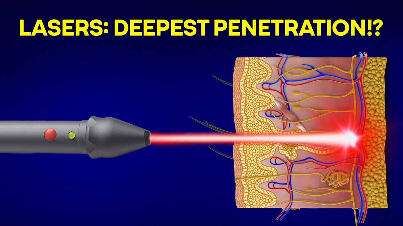 Laser Vs LED Light: Powermedic For MAXIMUM Penetration?!