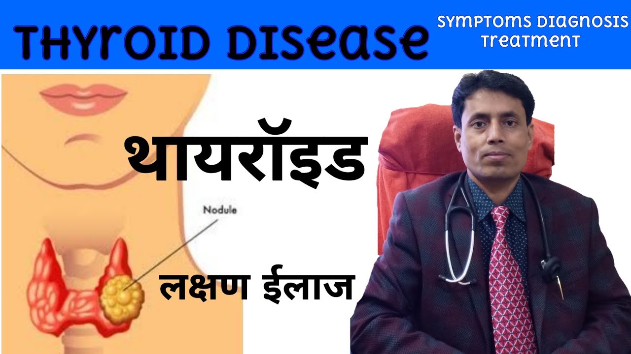 Symptoms of Thyroid disease // Thyroid ke lakshan // Diagnosis of Hypothyroidism // DR SANJAY KUMAR