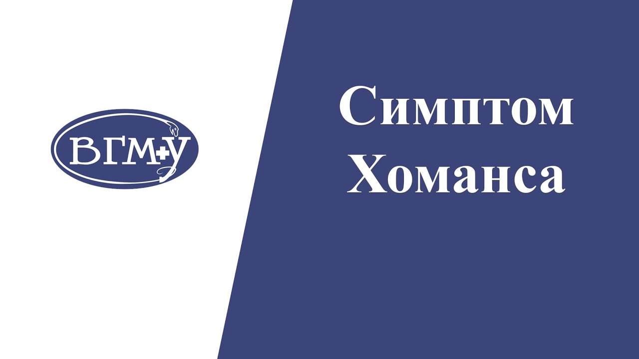 Симптом Хоманса