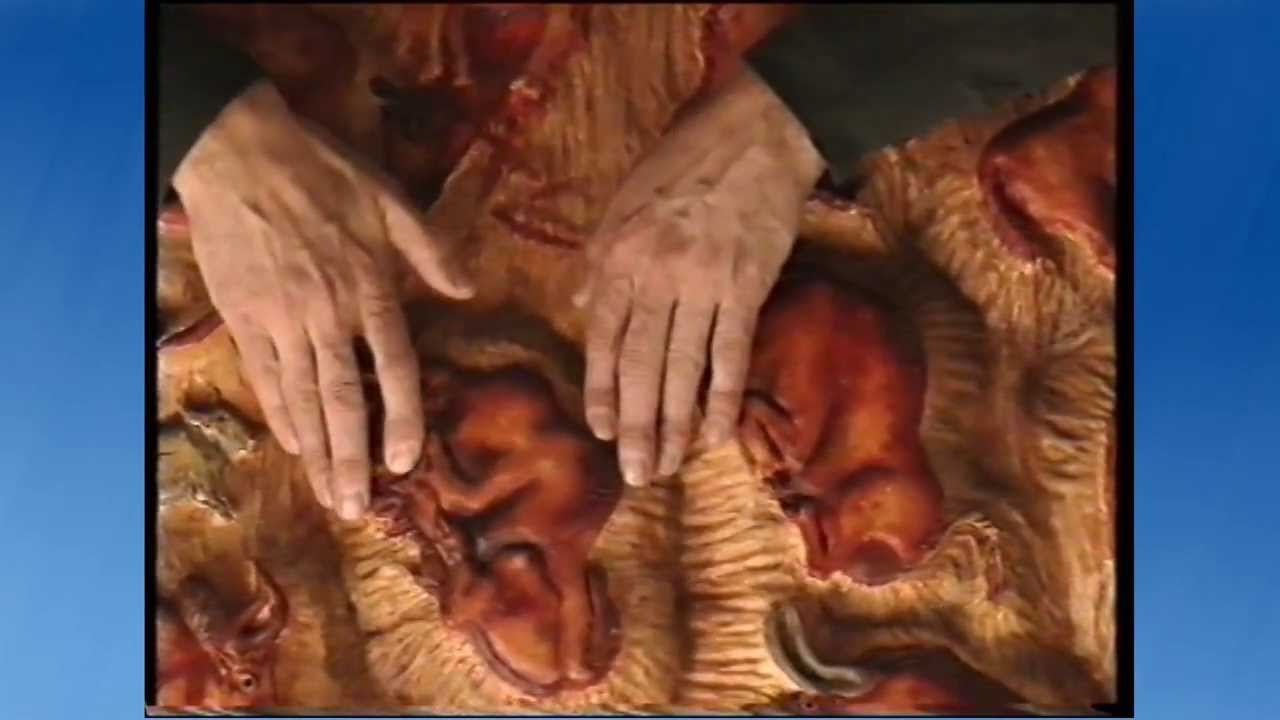 Documental Sordoceguera