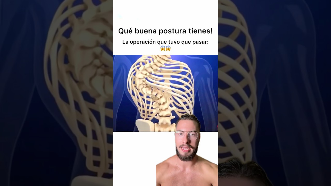 Te ense&ntilde;o la operaci&oacute;n para corregir la escoliosis