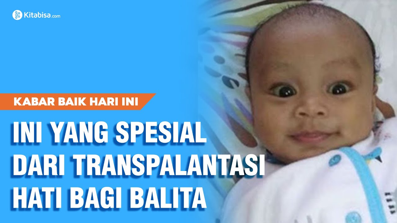 Jarang Terjadi! Transplantasi Hati Untuk Balita! | Kabar Baik Hari Ini
