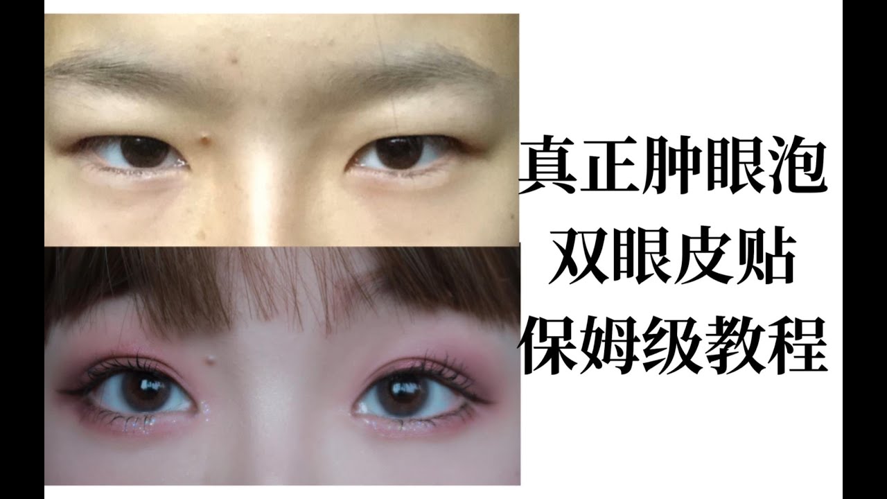 真正肿眼泡/双眼皮贴保姆级教程-肿眼泡必看!怎么贴出完美双眼皮?-双眼皮贴教程-拯救肿眼泡!