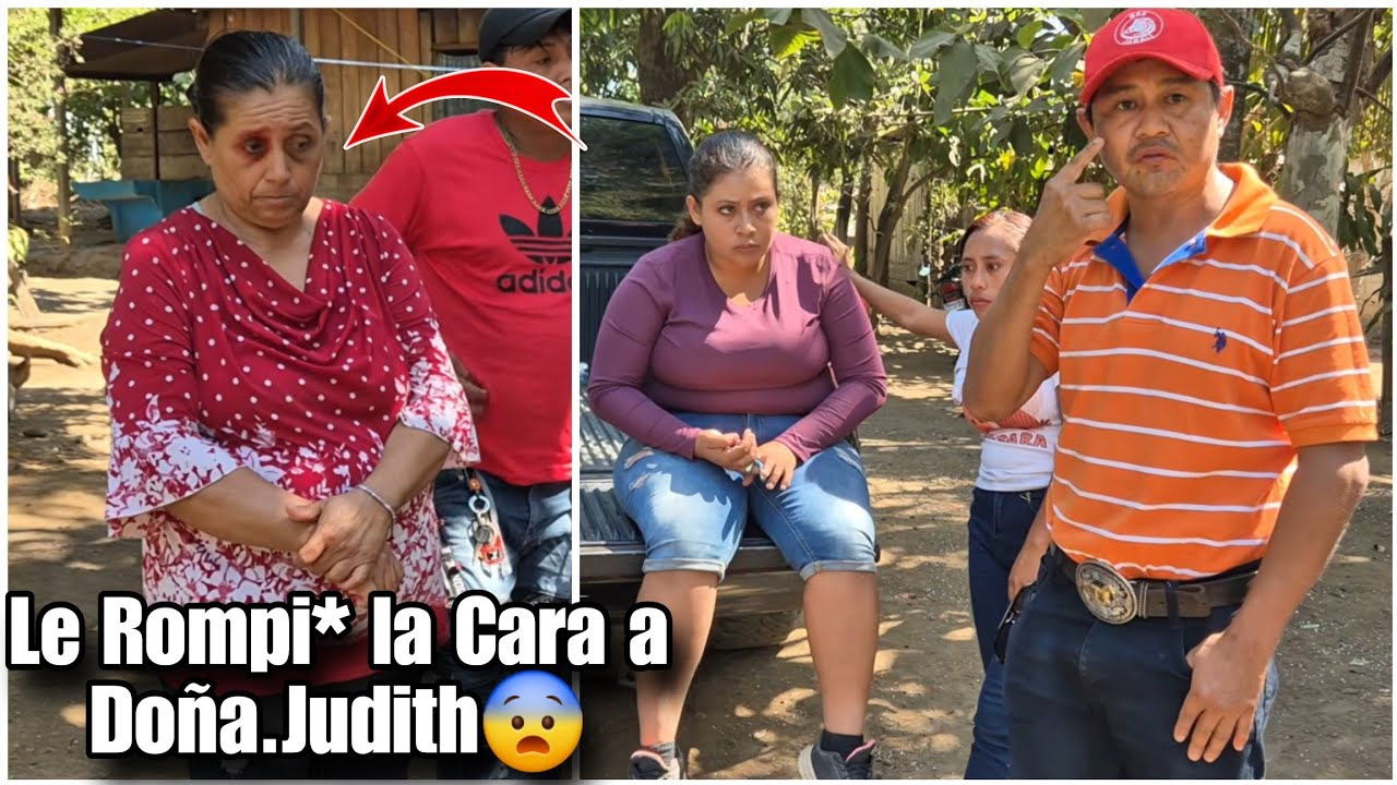 Chino no le tuvo compasión a su Suegra mira como le dejó la cara con el ojo mor4do estába😱