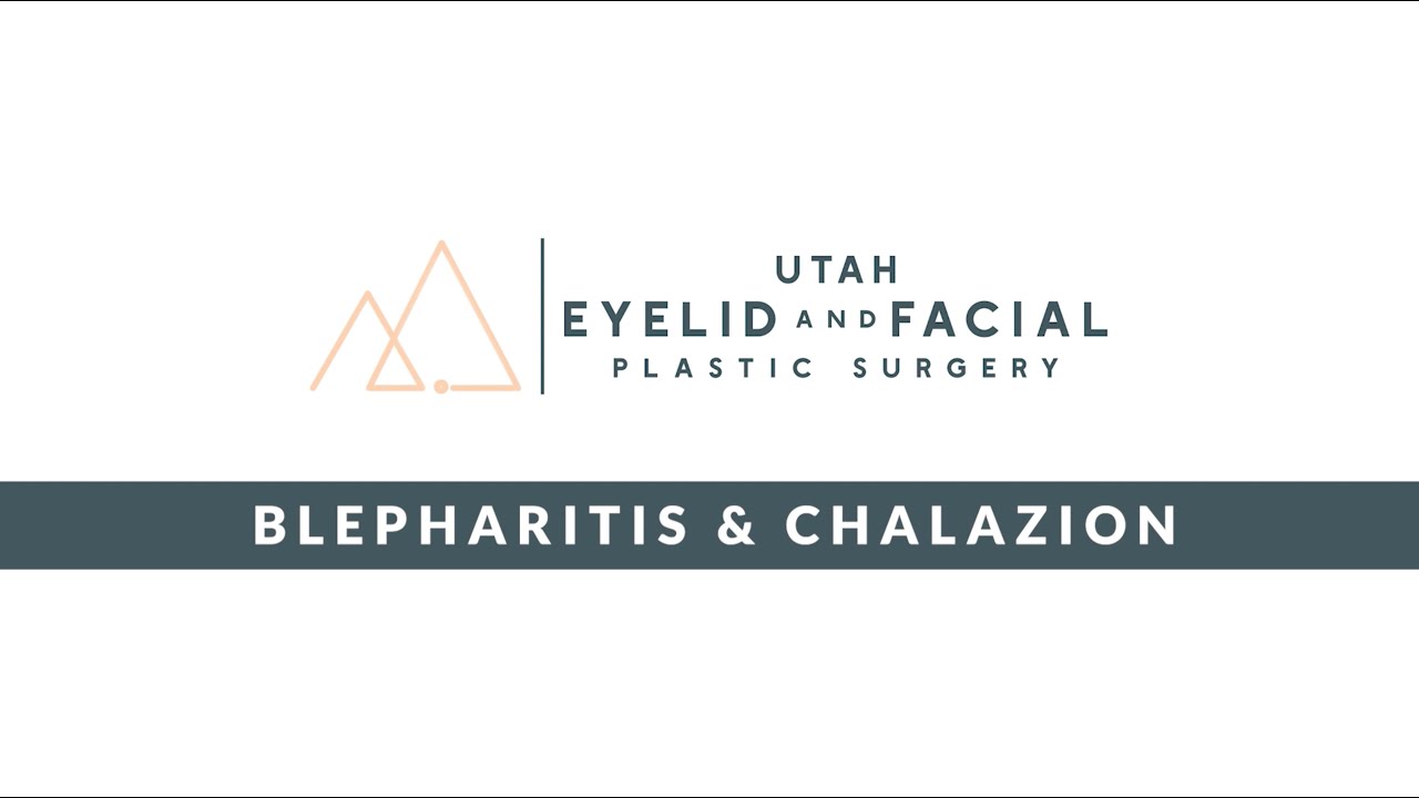 Styes, Chalazion & Blepharitis