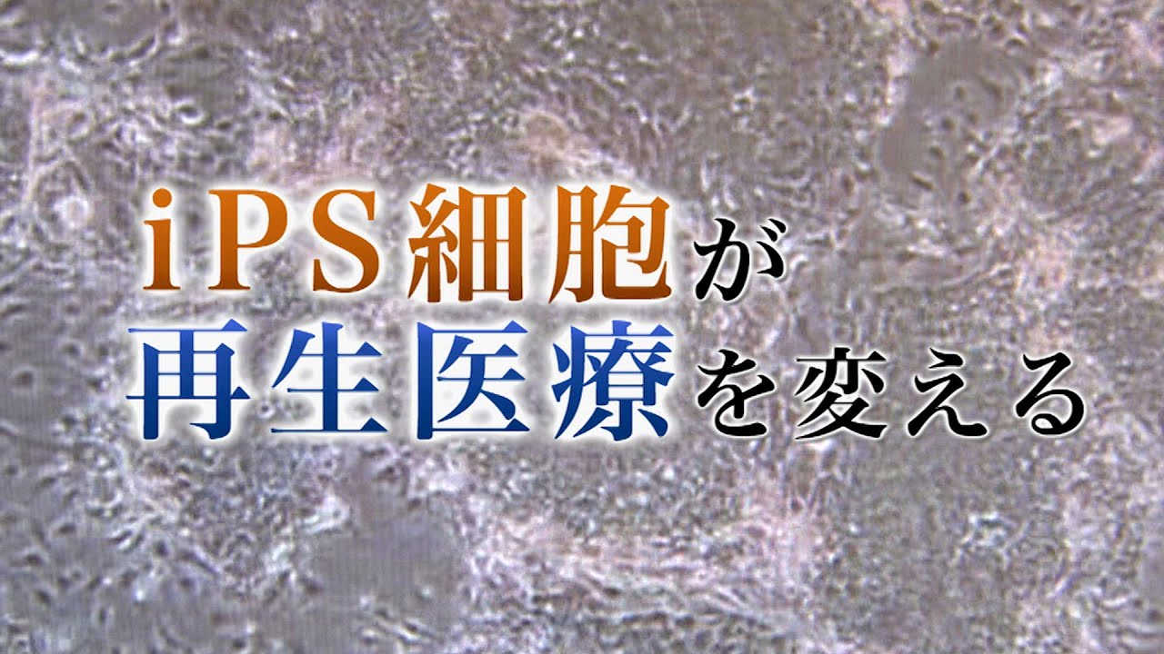 iPS細胞が再生医療を変える | ガリレオX第2回