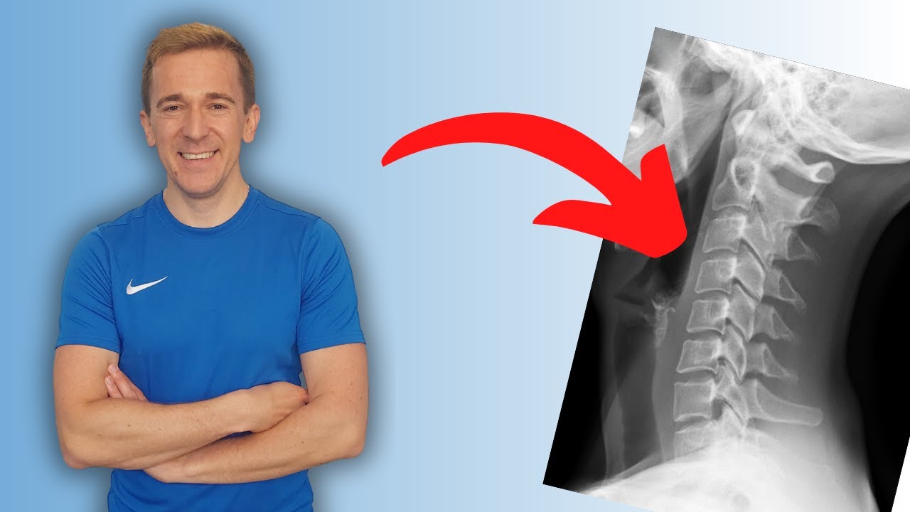 TRAKCJA KRĘGOSŁUPA SZYJNEGO-  bezpieczne technika.