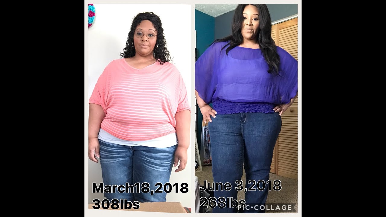 2 Month Post Opt VSG Surgery -40lbs down