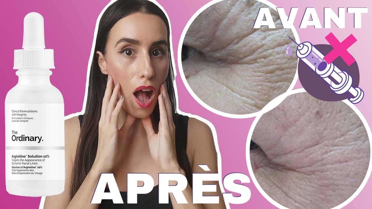 COMMENT DIMINUER LES RIDES D'EXPRESSION SANS BOTOX ? ARGIRELINE 10% THE ORDINARY
