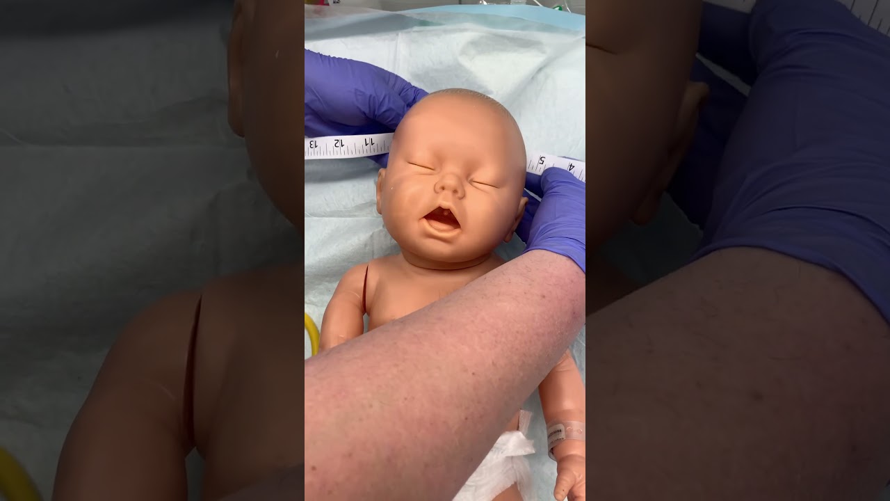 Neonatal head circumference