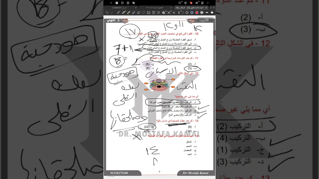 حل واجب الهيكل العظمي (المحوري والطرفي) تالتة ثانوي 2026 بالتوفيق 💪❤