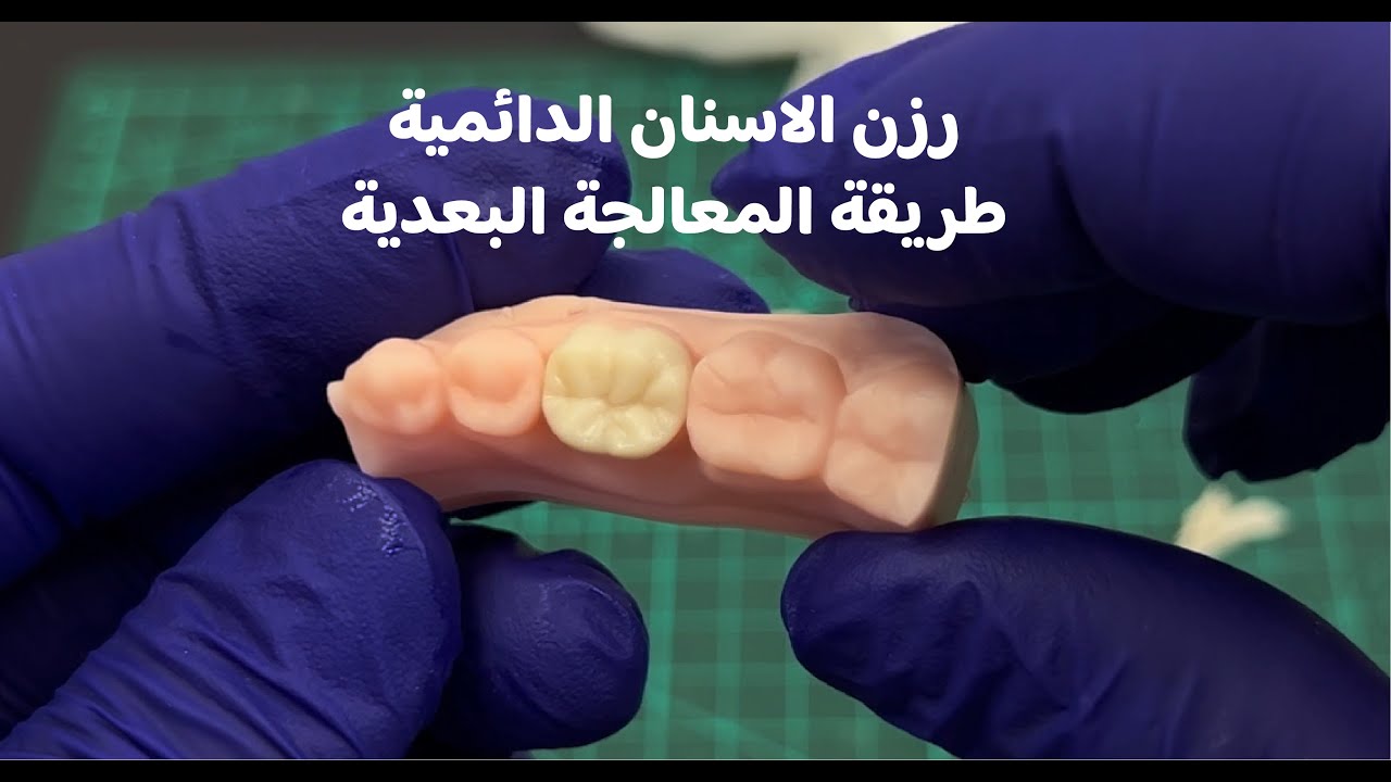 النسخة العربية/ المعالجة البعدية لرزن الاسنان الدائمية / 3D Printed Permanent  Restoration Resin