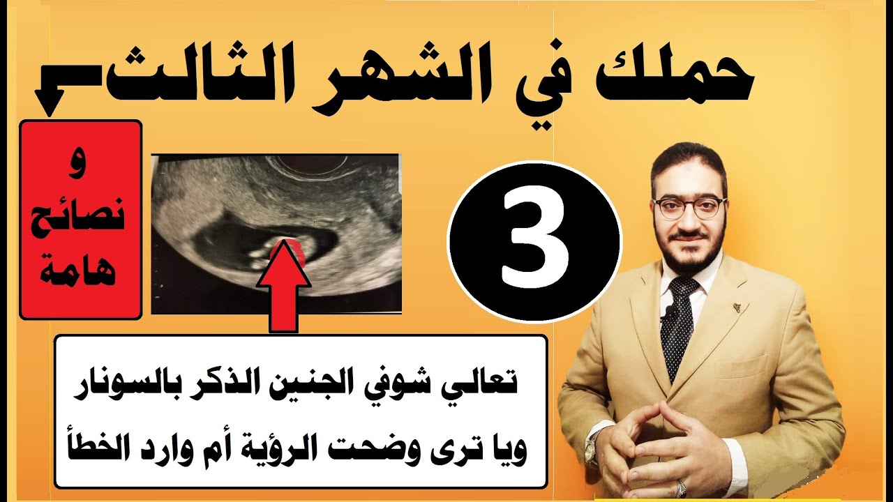 حملك في الشهر الثالث ونصائح هامة وتعالي شوفي الجنين الذكر بالسونار ويا ترى وضحت الرؤية أم وارد الخطأ