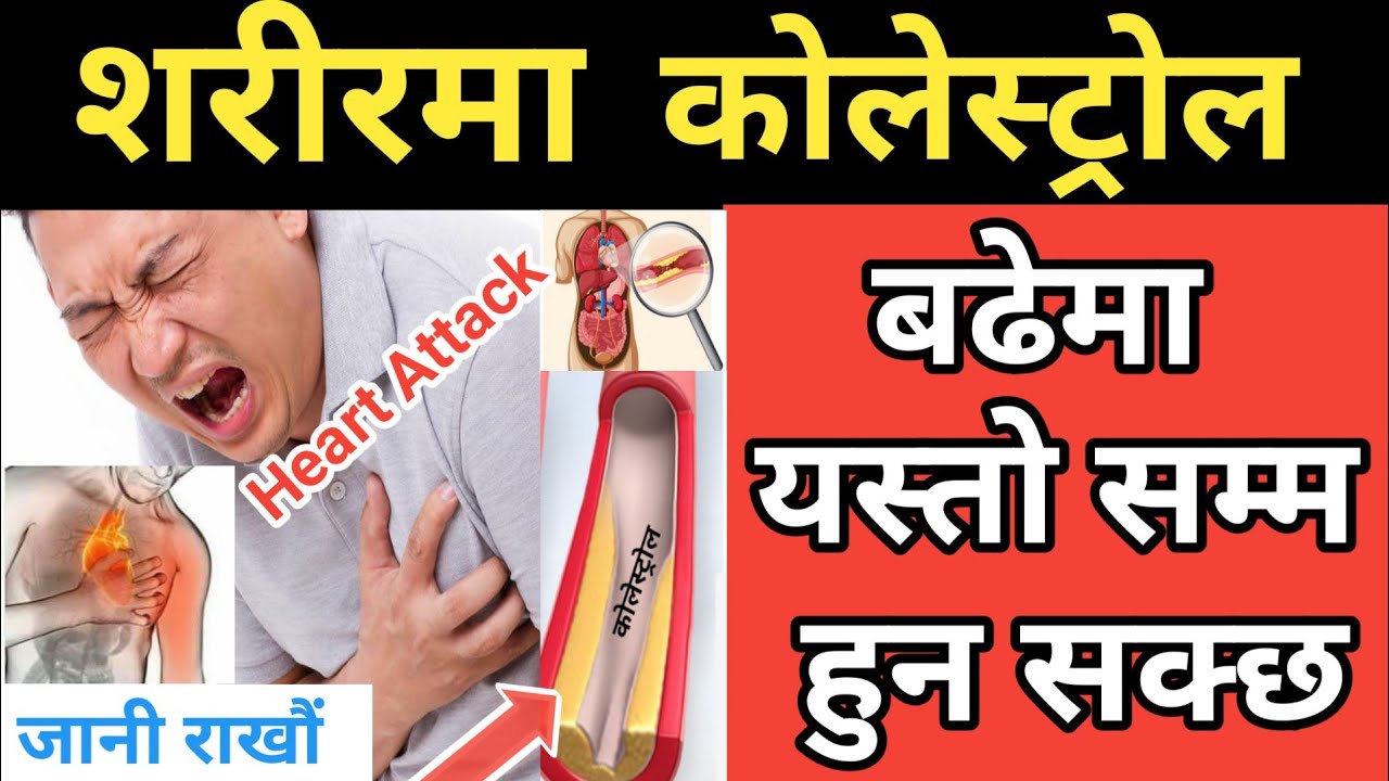 Nepali Health Tips शरीरमा कोलेस्ट्रोल बढी भएमा यस्तो सम्म हुन सक्छ Effect Of High Cholesterol