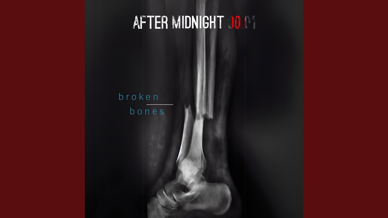 Broken Bones