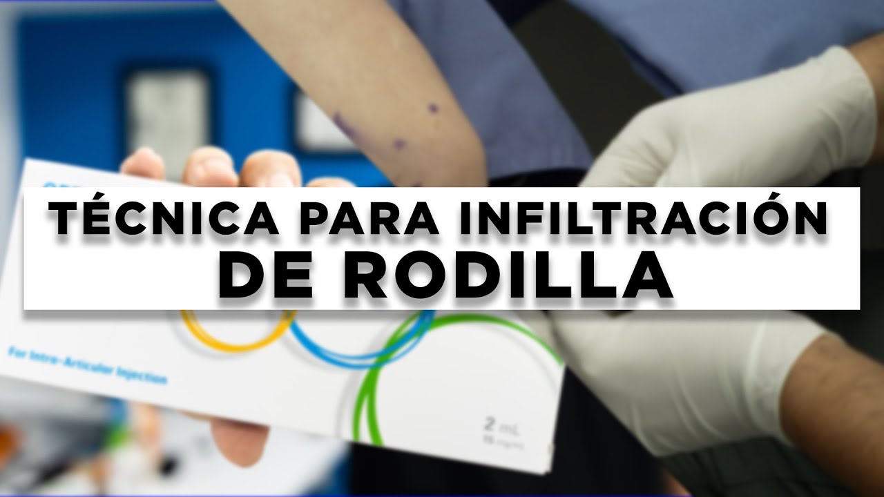 Cómo realizar una inyección intra-articular de rodilla de principio a fin (PACIENTE REAL)