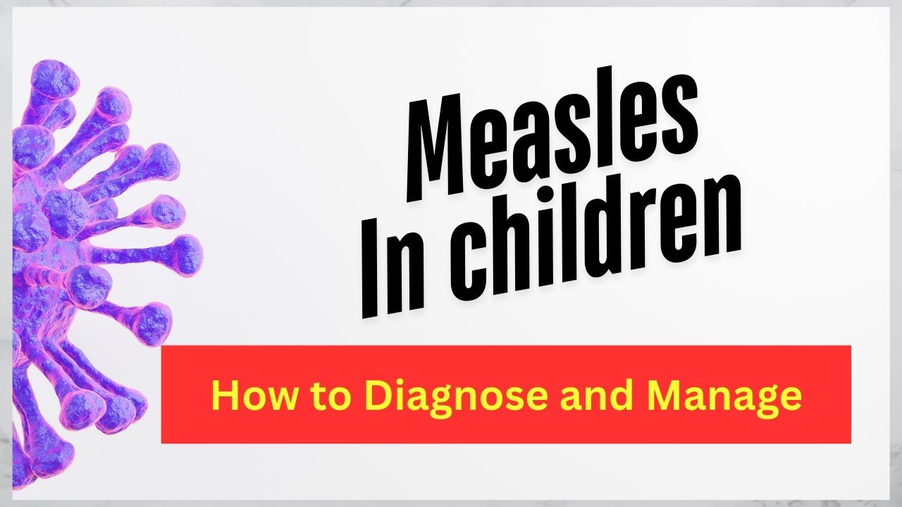 Understanding Measles in Children: Symptoms , Care, and Prevention.