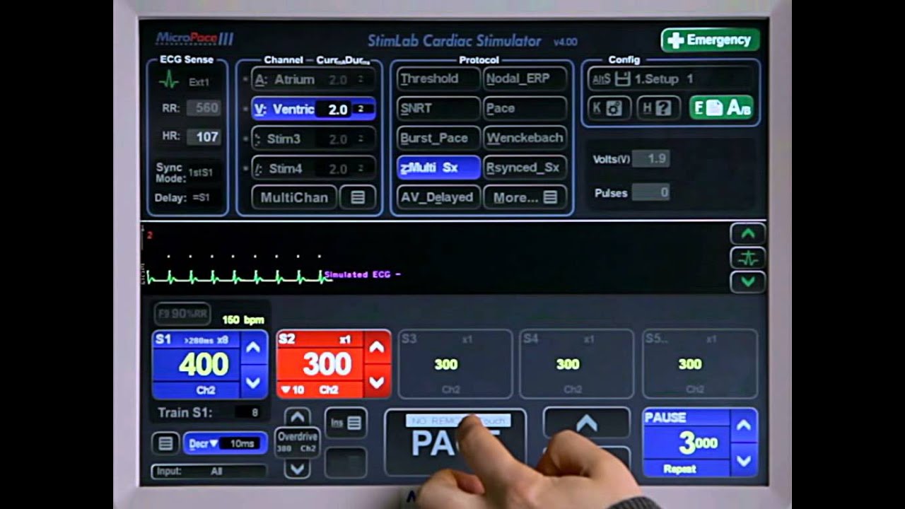 4E - Pacing Protocols - MultiSx 1: VT Study Basic