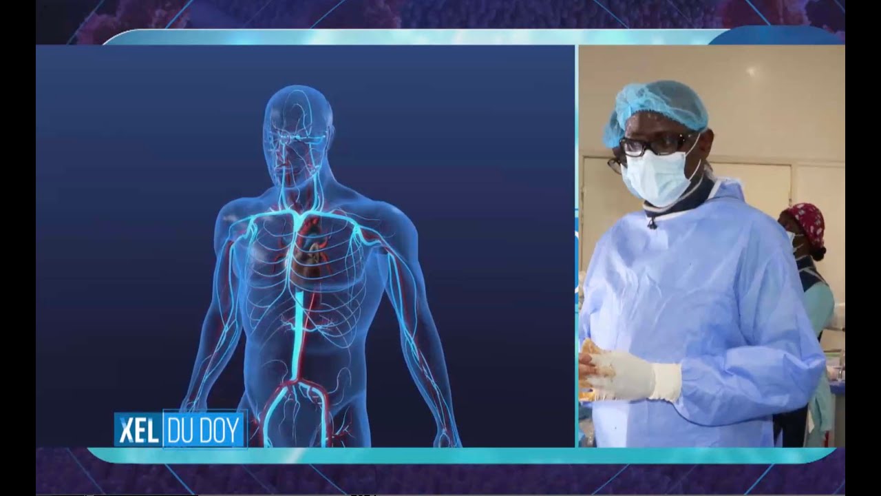 📺 XEL DU DOY (1e partie) / INVIT&Eacute; : Pr ALASSANE MBAYE CARDIOLOGUE