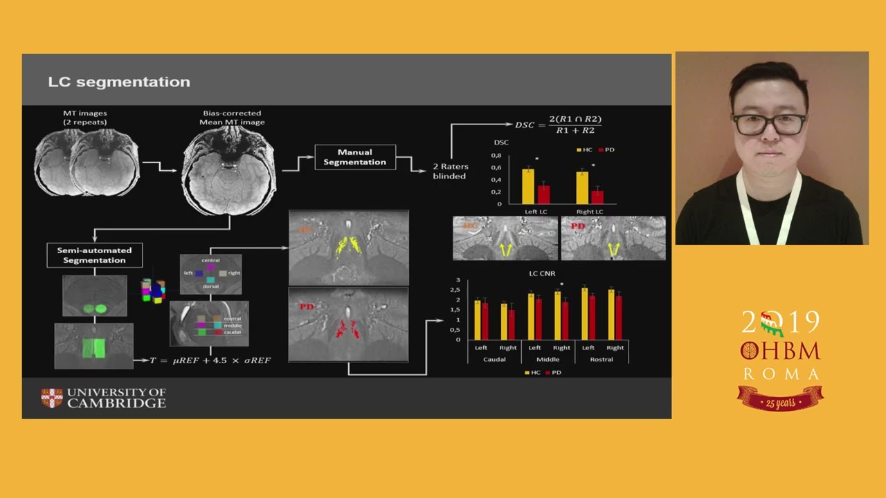 OHBM 2019 | Oral Sessions | Imaging the Locus Coeruleus in Parkinson&rsquo;s Disease with Ultra - hi&hellip;