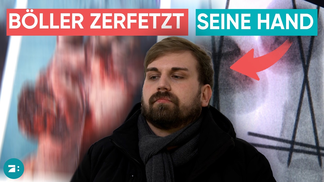 Er wurde mit einem B&ouml;ller beworfen - Hand und Mund zerfetzt
