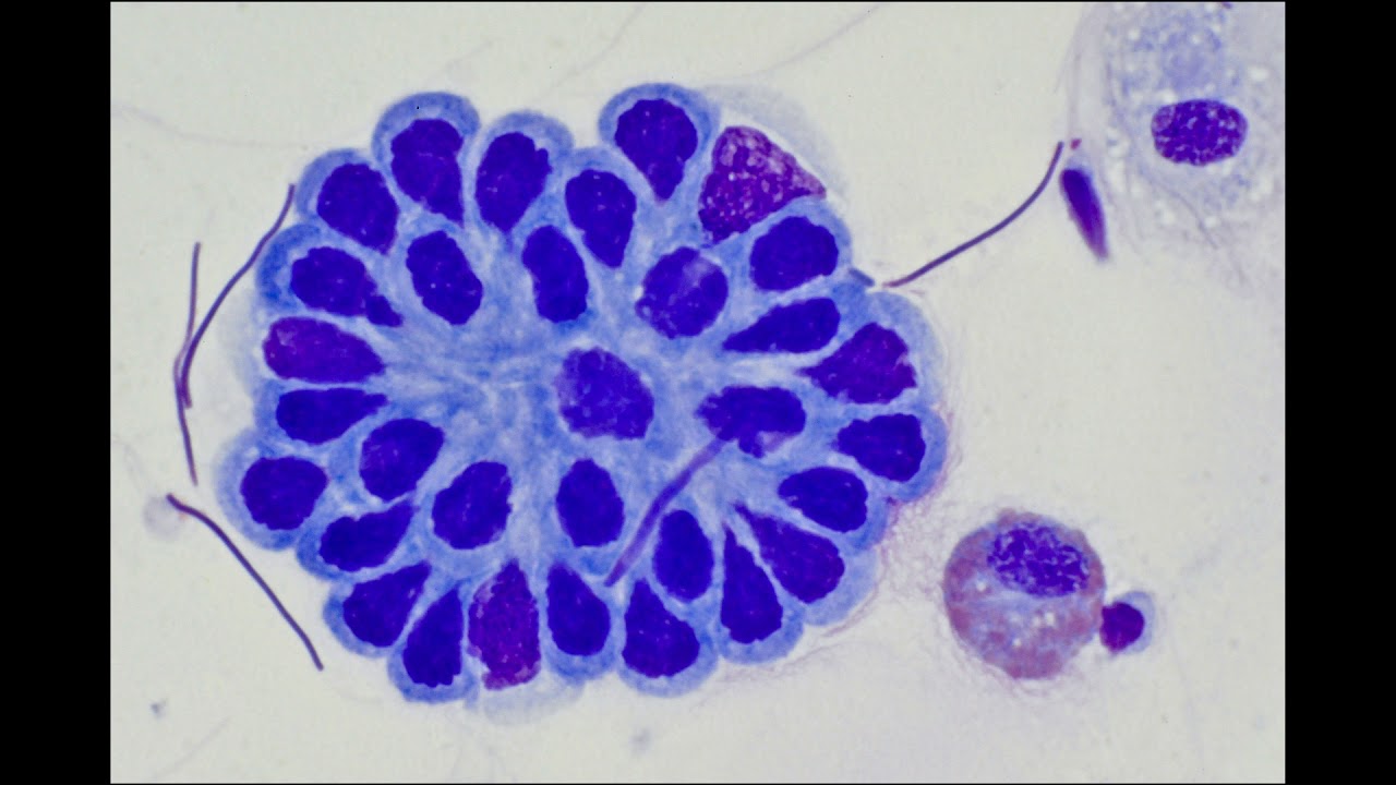 Earthworm Sperm and Monocystis Development