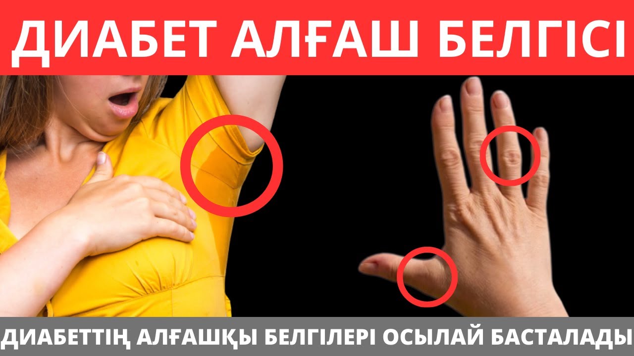 Қант диабетінің алғашқы ТОП 7 белгілері. Қант диабеті ауруының белгілері