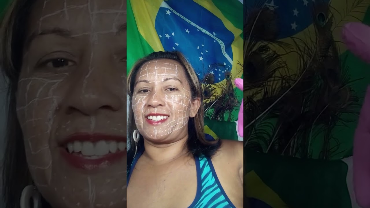 Armônização Facial e corporal. 