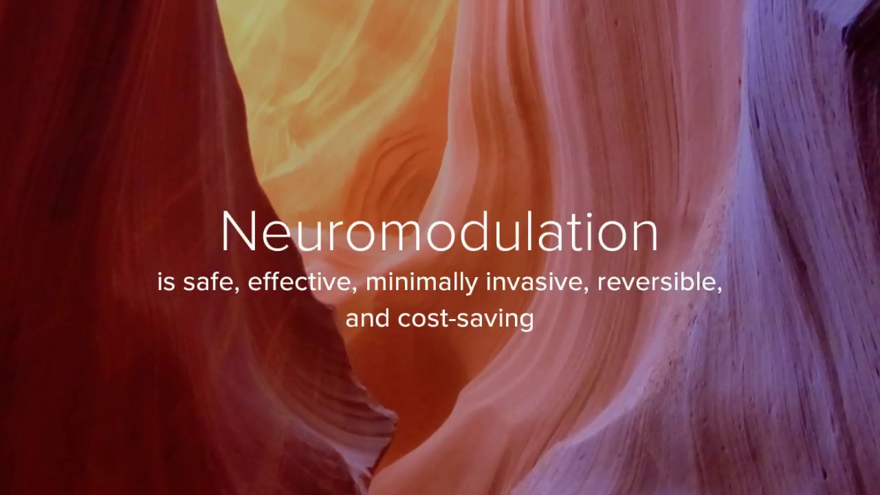 Post Amputation Pain and Neuromodulation 2018