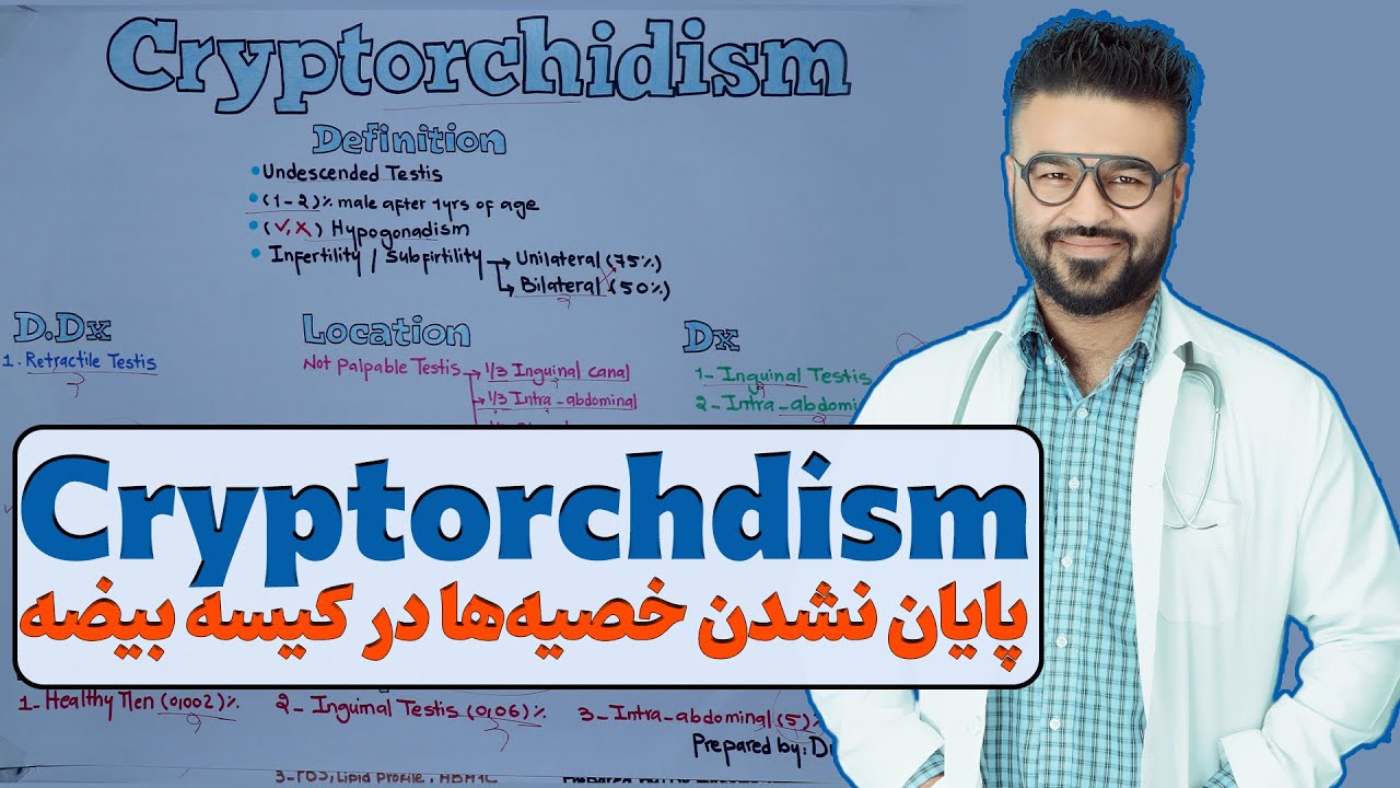 پایان نشدن خصیه ها در کیسۀ بیضه| Cryptorchidism