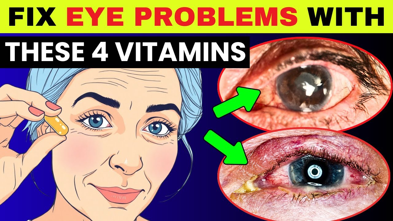 Top 4 Vitamins to Fix Eye PROBLEMS Fast! | Protect Your Eyes