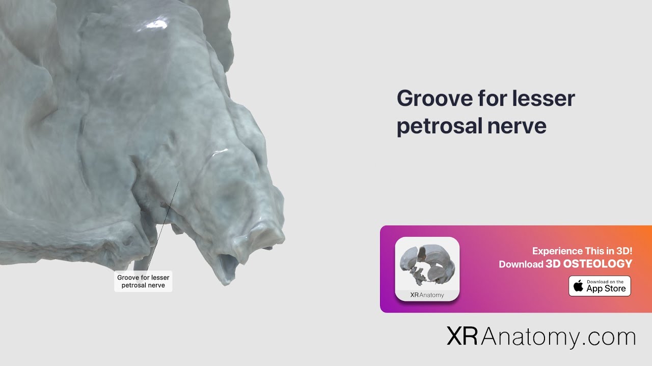 Temporal Bone   Groove for lesser petrosal nerve:
