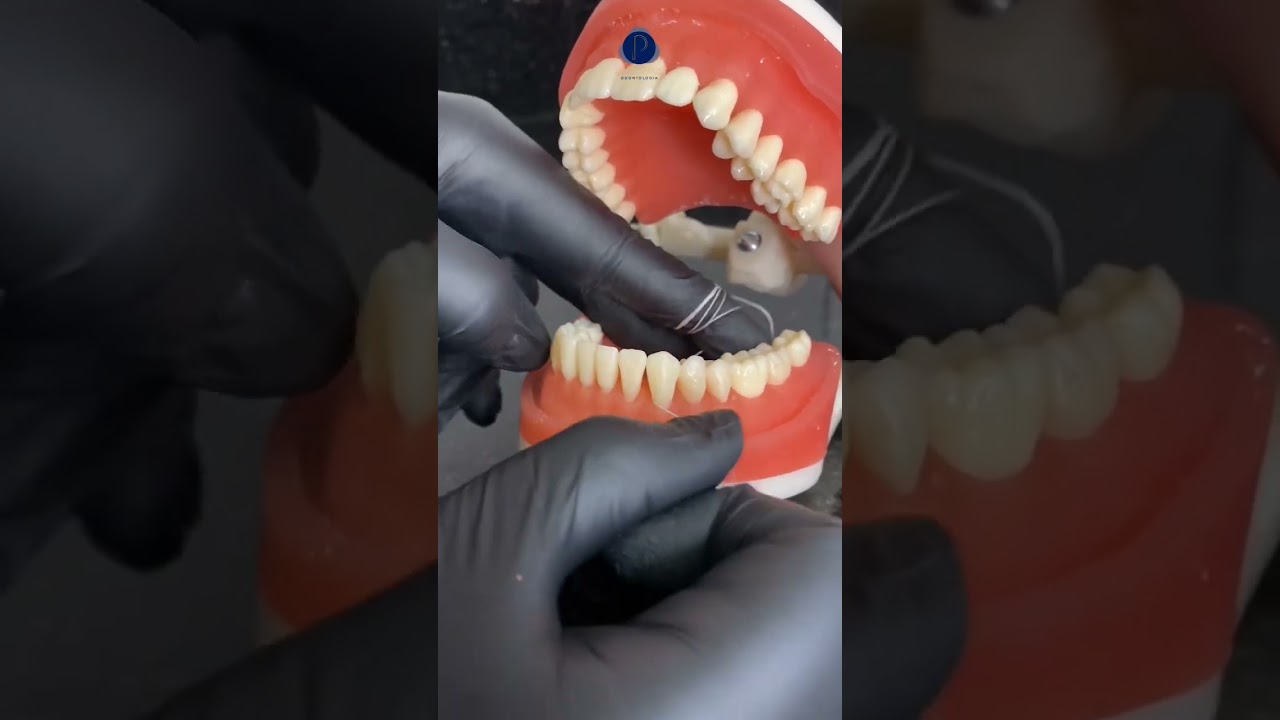 Aprenda a passar fio dental em menos de 1 minuto