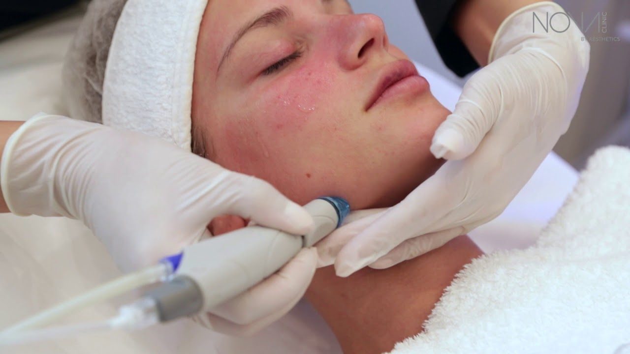 HydraFacial at Nova Clinic Dubai - Award Winning Facial Treatment